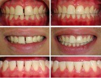 Dentistica Restauradora